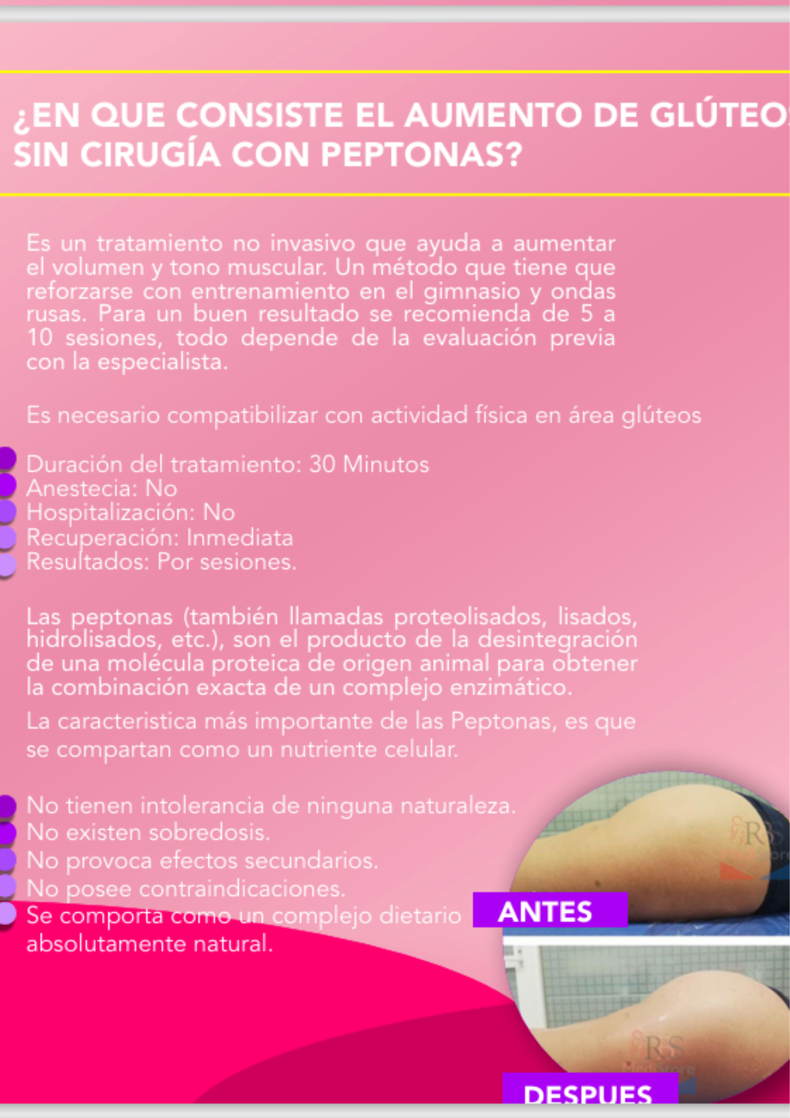 Peptonas Inyectables – Estimulación y Regeneración Muscular | Potencia tu Estética