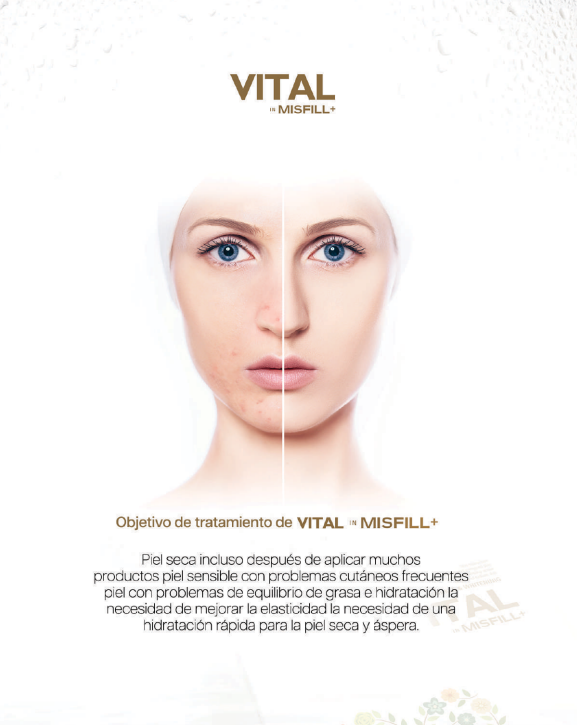 Misfill VITAL – Pack de 5 jeringas de 3ml | Skinbooster con ácido hialurónico para hidratación profunda
